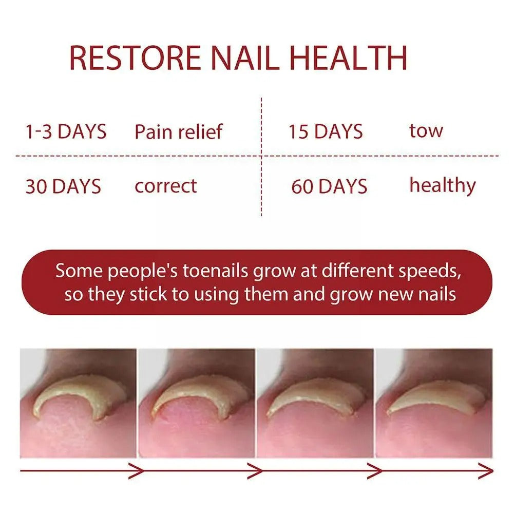 Anti Paronychia Relief Oil Cure Pain Reduce Ingrown Repair
