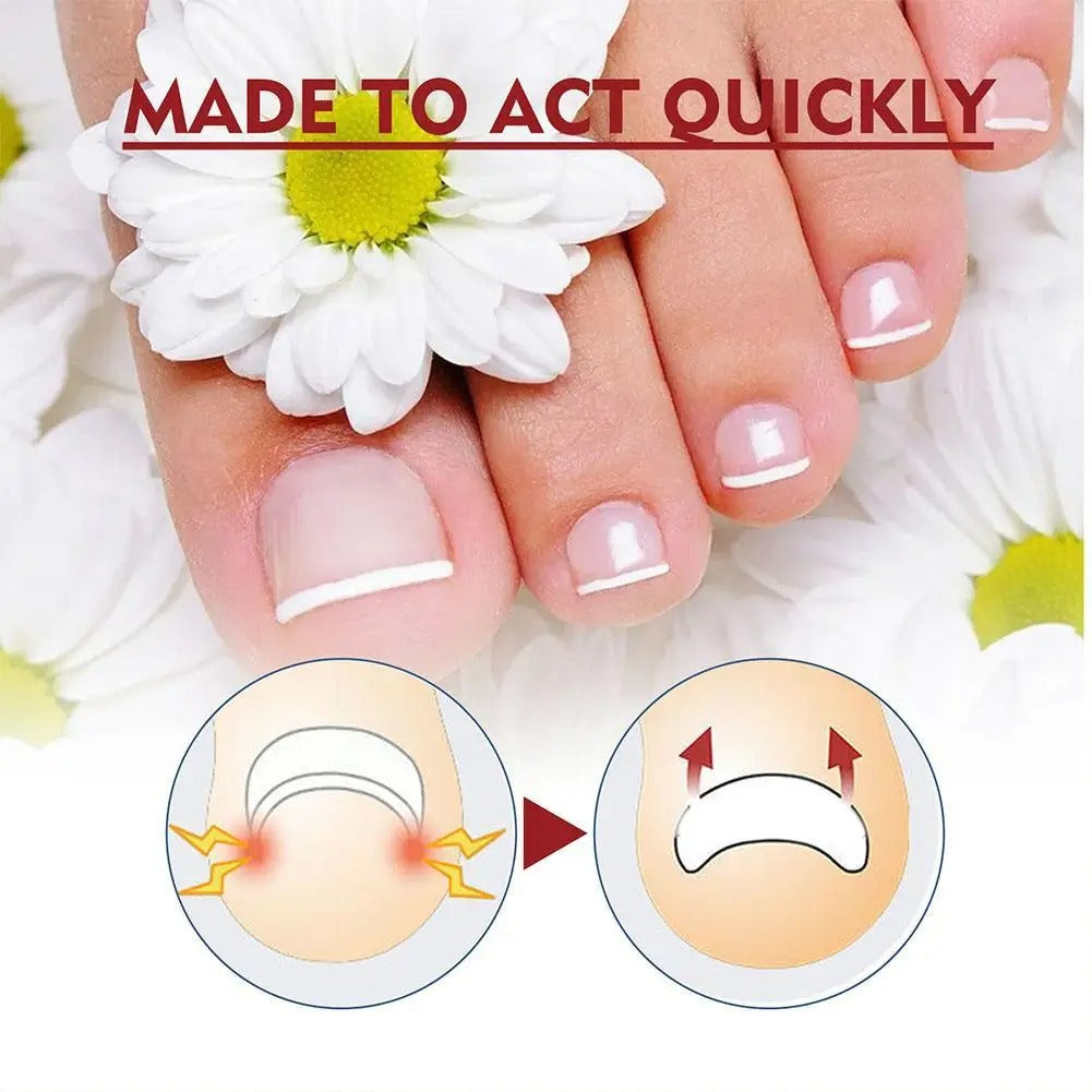 Anti Paronychia Relief Oil Cure Pain Reduce Ingrown Repair