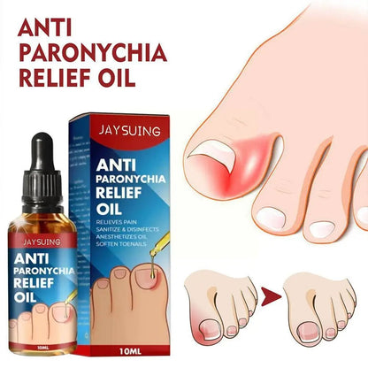 Anti Paronychia Relief Oil Cure Pain Reduce Ingrown Repair